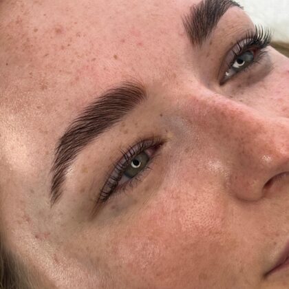 Brow Lifting Leibnitz